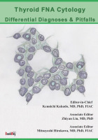 Thyroid FNA Cytology: Differential Diagnoses and Pitfalls : 編集: 覚道健一、劉志艶、廣川満良 | BookWay書店 BookWay書店 外国語版